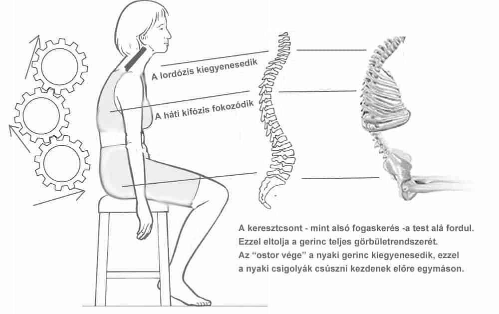 A nyaki gerincsérv mozgásterápiájának alapelvei 2