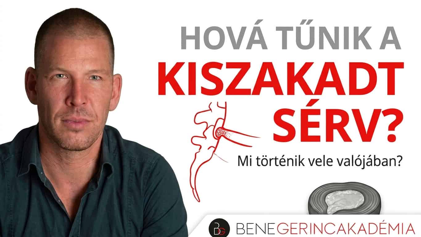 Öt éve kiszakadt porckorongsérvvel jött hozzám... (A hiba, amit sok oktató elkövet) 2